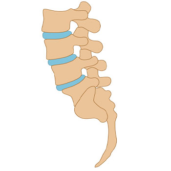 Mislaignments in spine return to proper position